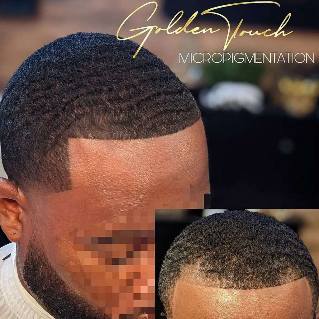 scalp micropigmentation results